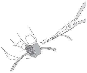 Insertion of Contacts Step 3